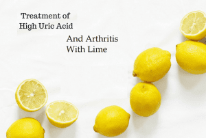 Treatment of High Uric Acid and Arthritis with Lime